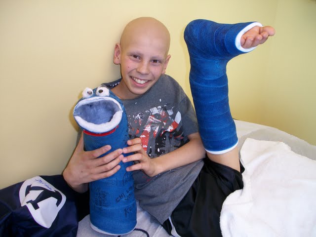 Tim's Van Ness Rotation Plasty and his decorated cast